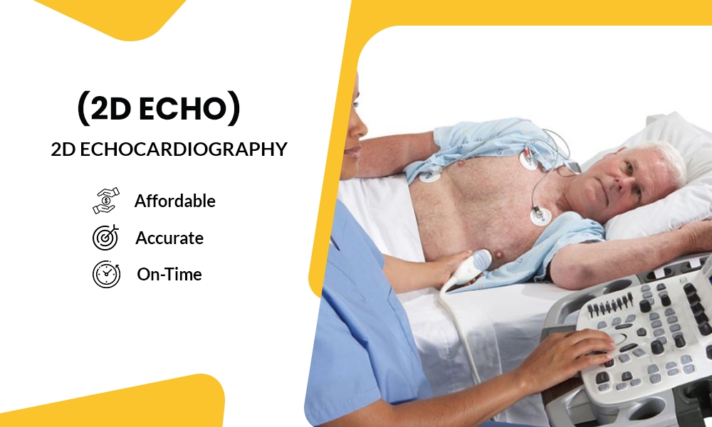 echo test price delhi