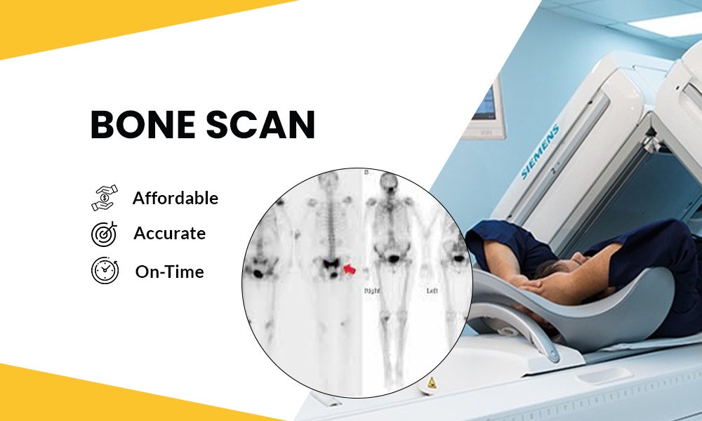 Nuclear medicine bone scan