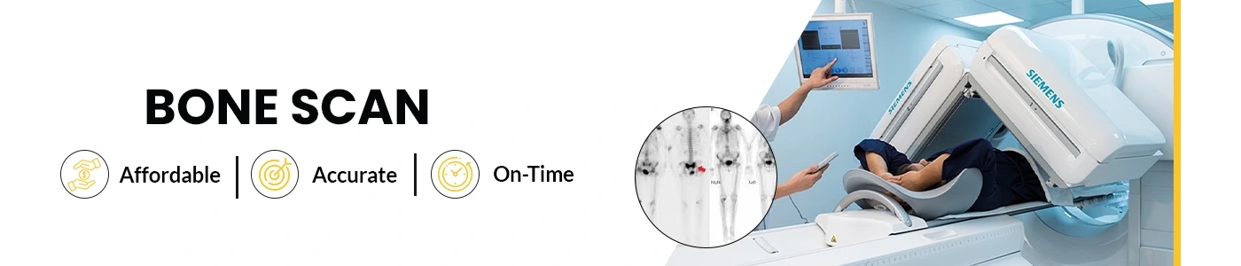 Nuclear medicine bone scan