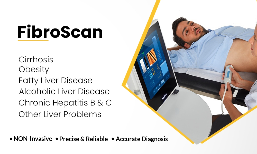 fibroscan test