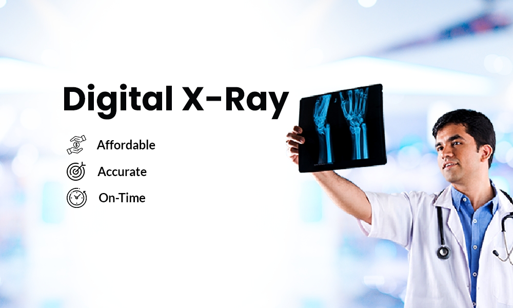 x ray cost in delhi